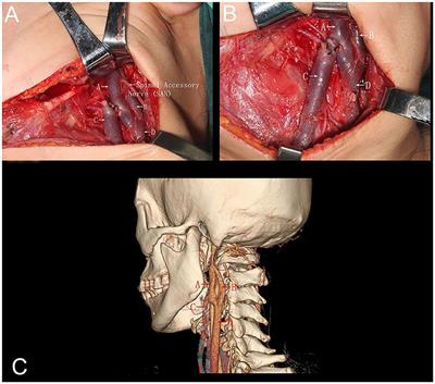 Internal Jugular Vein Fenestration and Duplication: Anatomical Findings, Prevalence, and Literature Review